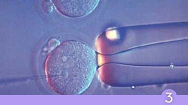 Fecundacion in Vitro