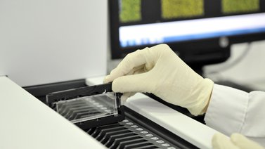 PGS/PGT-A/CCS. Estudio cromosómico del embrión