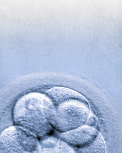 BASSO LIVELLO DELLA RISERVA OVARICA