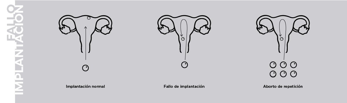Unidad de fallo de implantación embrionario