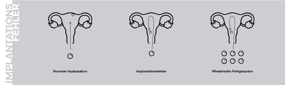 Unidad de fallo de implantación embrionario