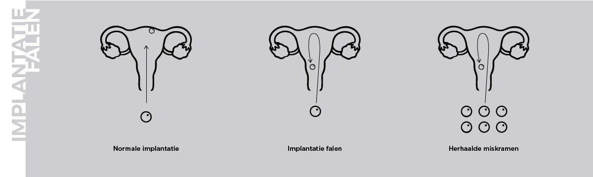 Unidad de fallo de implantación embrionario
