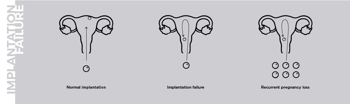 Unidad de fallo de implantación embrionario