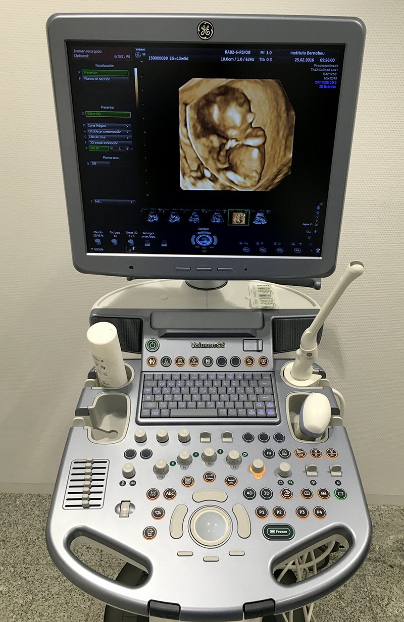 Ecografía 4D - Instituto Bernabeu de Albacete