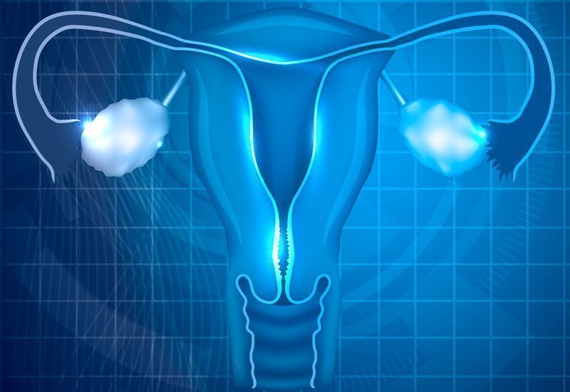 Удаление яичника можно забеременеть после. Бесплодие. Яичниковая беременность. Endometrial receptivity Analysis.
