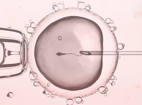 Calendario FIV: Fases de un tratamiento de FIV vs ICSI