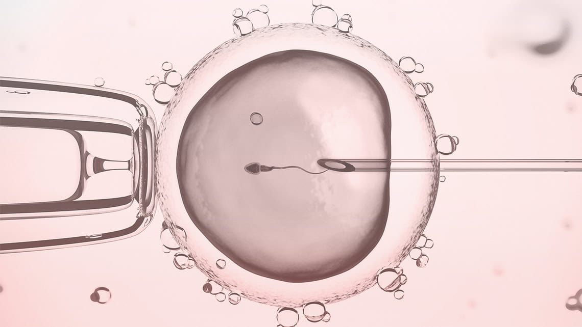 Calendario FIV: Fases de un tratamiento de FIV vs ICSI