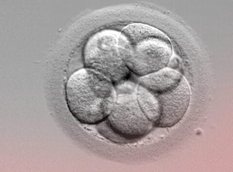 Embryonentransfer: Wie viele Embryonen sollten transferiert werden?