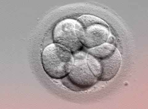 Transferencia embrionaria: ¿Cuántos embriones es conveniente transferir?