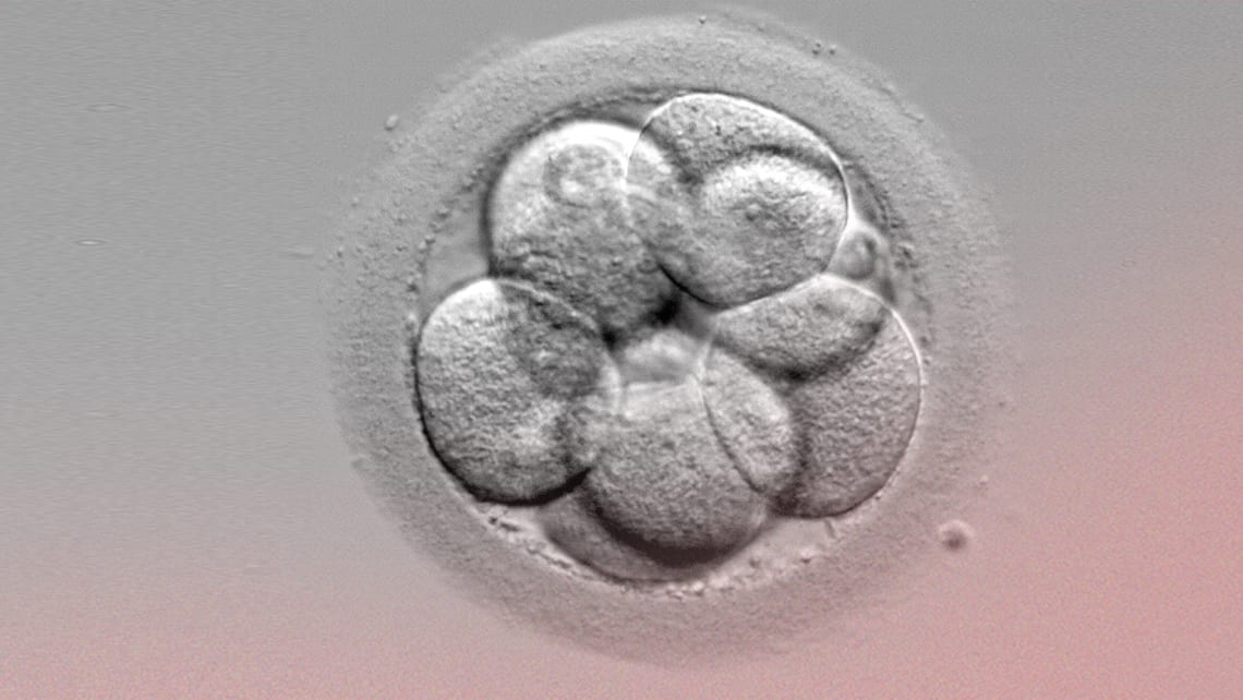 Embryonentransfer: Wie viele Embryonen sollten transferiert werden?