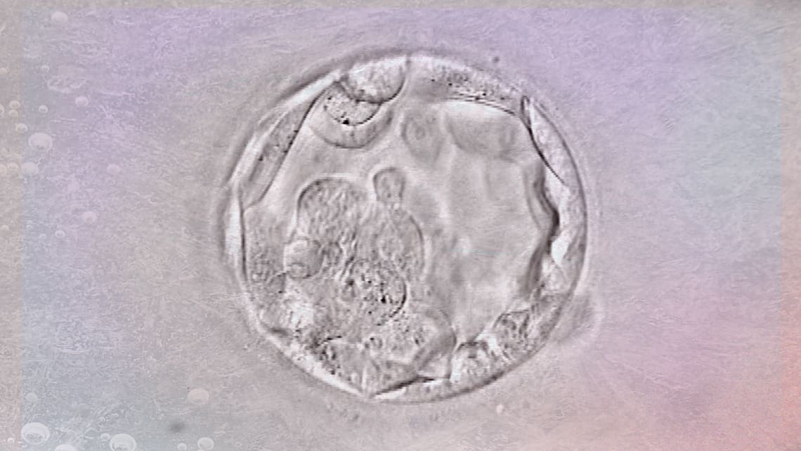 Kryokonservierten Embryonen: wirkt sich die Lagerzeit auf der Bank später auf die  Lebensfähigkeit aus?