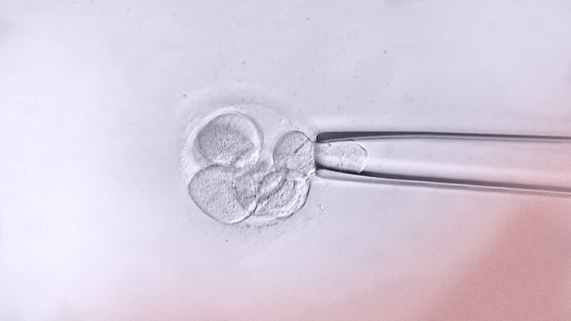 ¿En qué consiste la biopsia del embrión?
