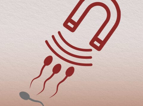 Using Magnetic Fields to Select Healthy Sperm: MACS (Magnetic Activated Cell Sorting)