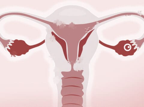 Regelmäßige vs. unregelmäßige Ovulation