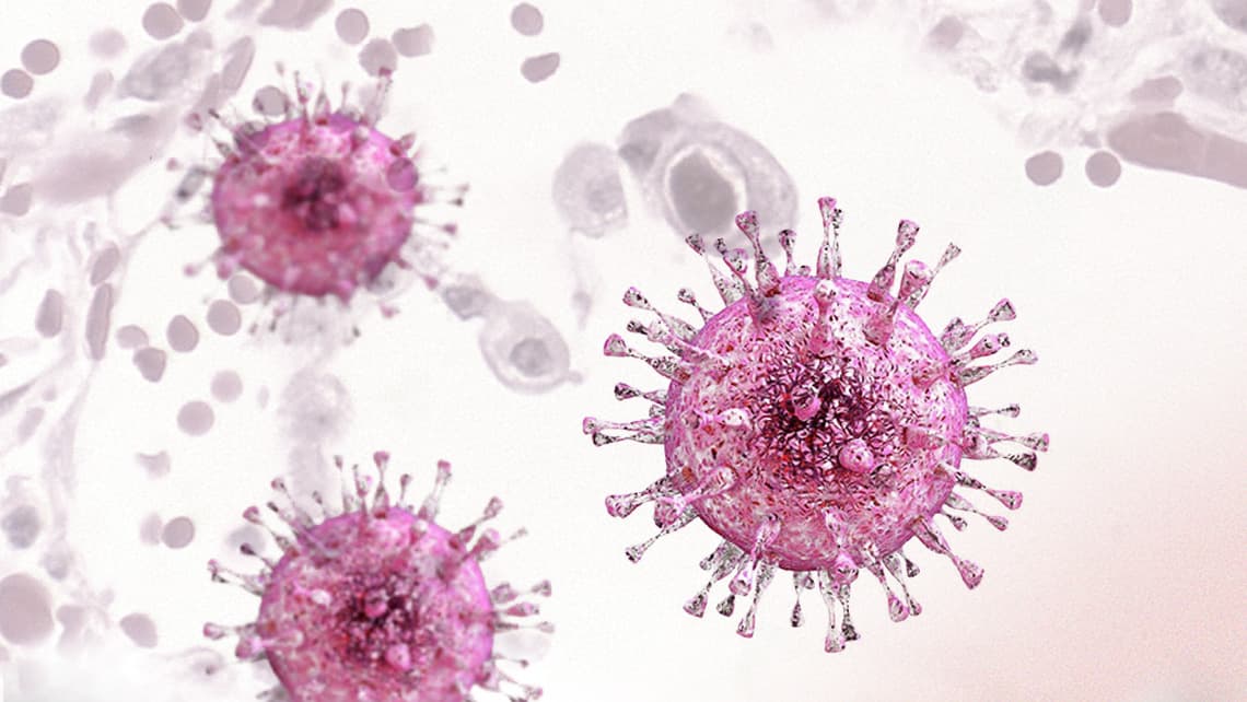 Cytomegalovirus: symptoms, transmission and treatment