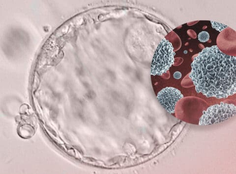 Inmunologia influisce sull’errore di annidamento e aborti?