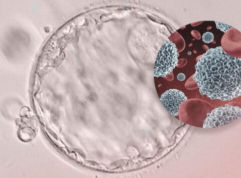 Kann das Immunsystem einen Einfluss auf Implantationsfehler und wiederholte Fehlgeburten haben?