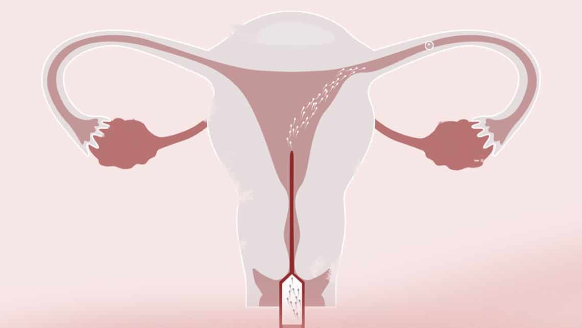 Cos’è, in cosa consiste e quando è consigliata l’inseminazione?