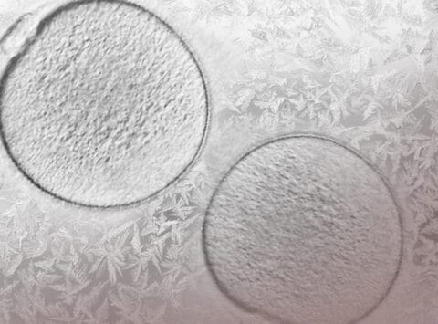 10 cose da sapere se si desidera congelare i propri ovuli