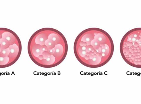 Criteria for embryo classification