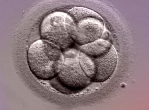 Warum sind nicht alle übrig gebliebenen Embryonen eines Zyklus der In-vitro-Fertilisation für die Tiefkühlung geeignet?