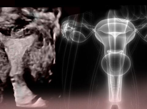 What is the endometrium?