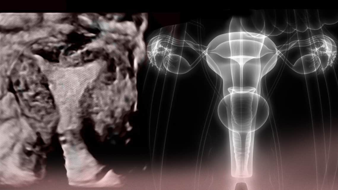 ¿Qué es el endometrio?