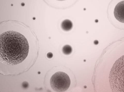 Erhöht die ovarielle Stimulation bei der In-vitro-Fertilisation das Risiko für gynäkologischen Krebs?