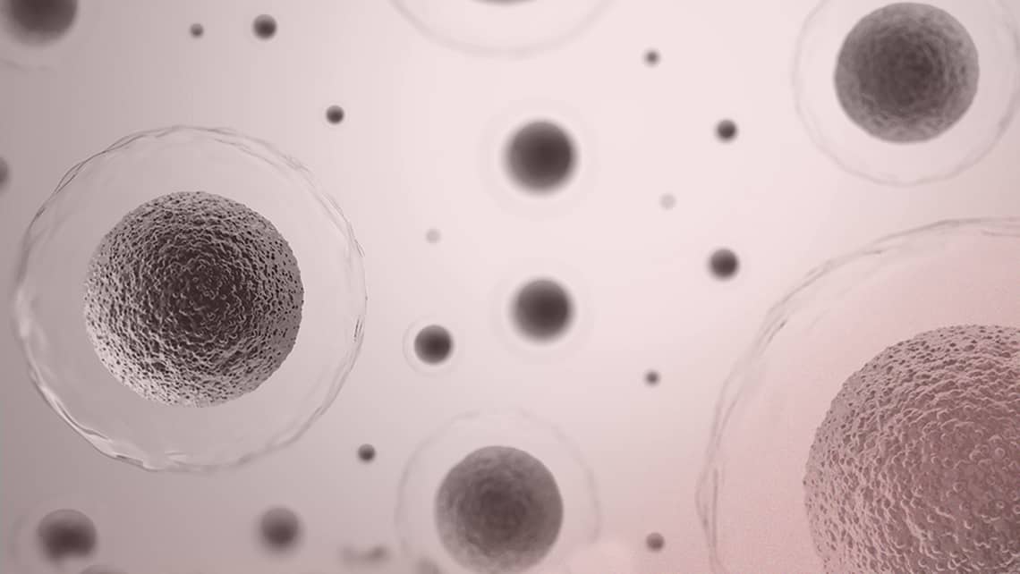 ¿Aumenta el riesgo de cáncer ginecológico la estimulación ovárica de la fecundación in vitro?
