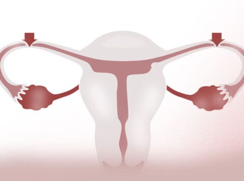 Is it possible to become a mother after tubal ligation?