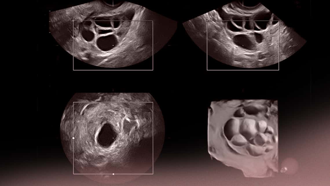 how big is an ovary