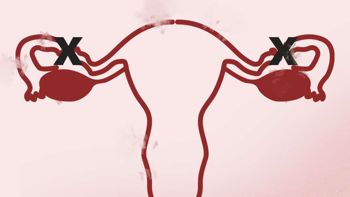 ¿Es posible ser madre tras la ligadura de trompas?