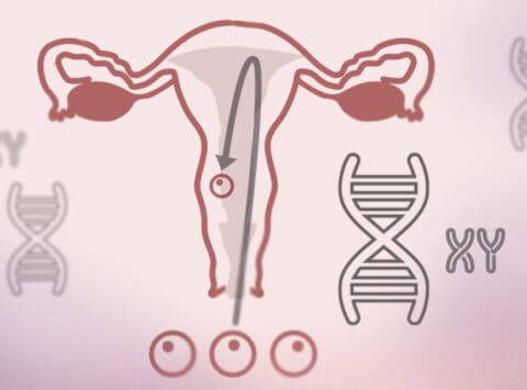 Chromosomalen Veränderungen bei wiederholten Fehlgeburten