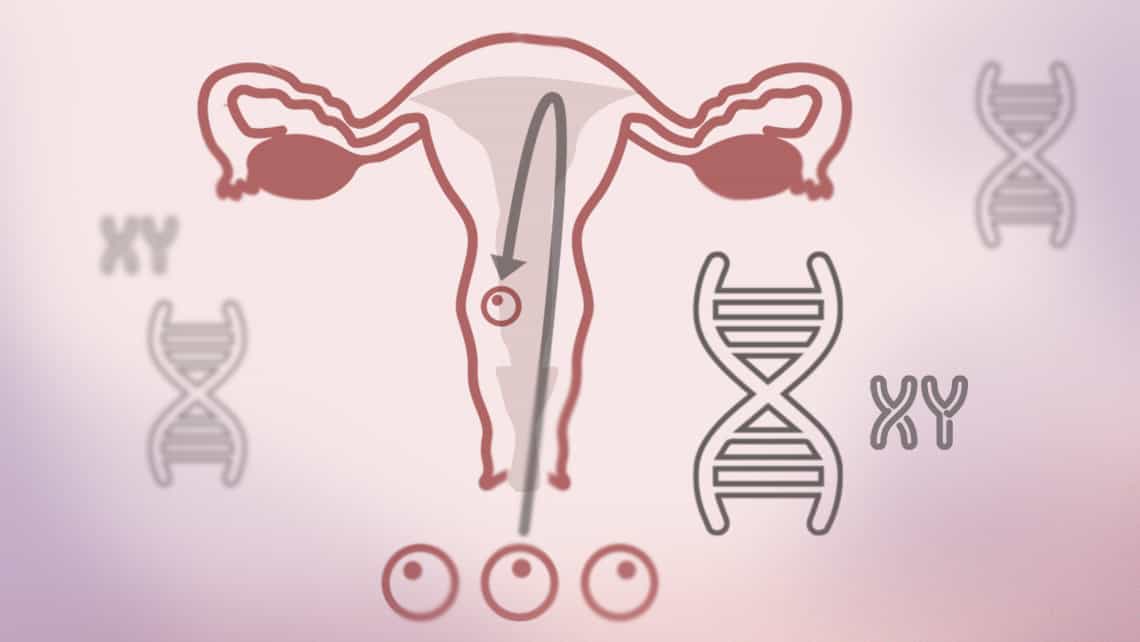 Alteraciones cromosómicas en abortos de repetición