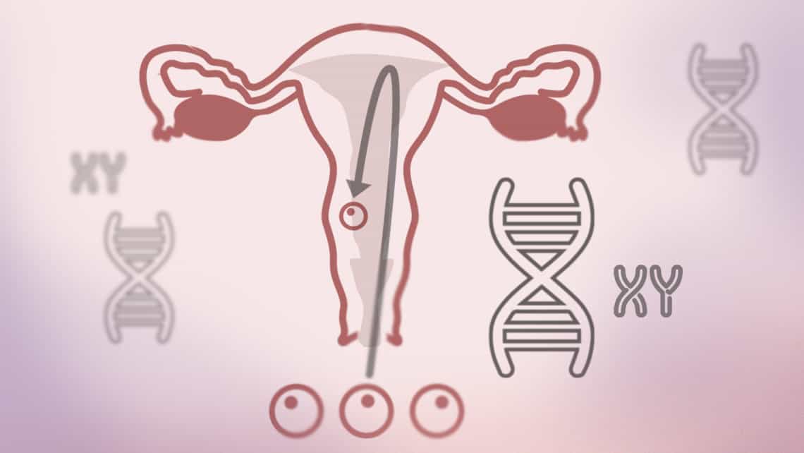 Chromosomalen Veränderungen bei wiederholten Fehlgeburten