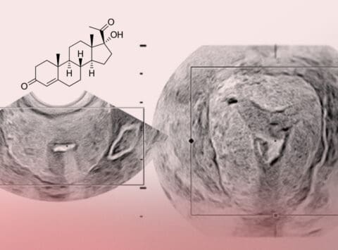 Progesterone and its role in reproduction