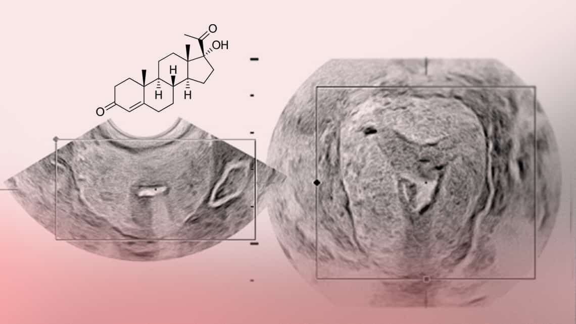 Progesterone and its role in reproduction