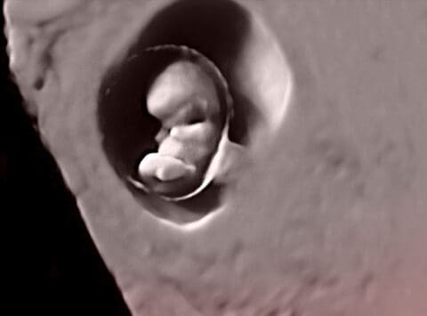 The miracle of embryo implantation