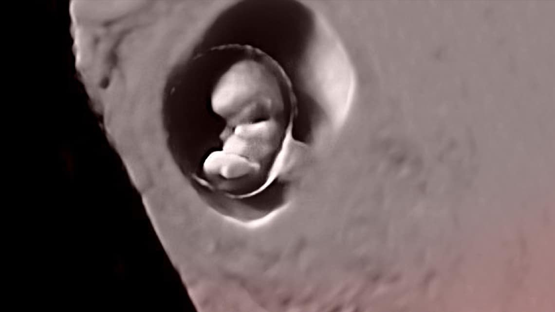 El milagro de la implantación del embrión