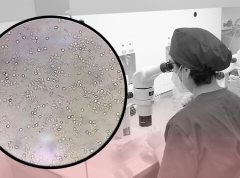 L´azoospermia nel laboratorio di FIV