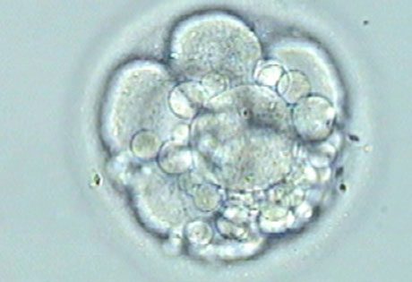 What is the impact of obesity on male fertility?