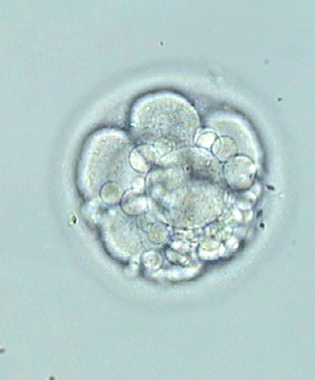 Einfrieren der Embryo