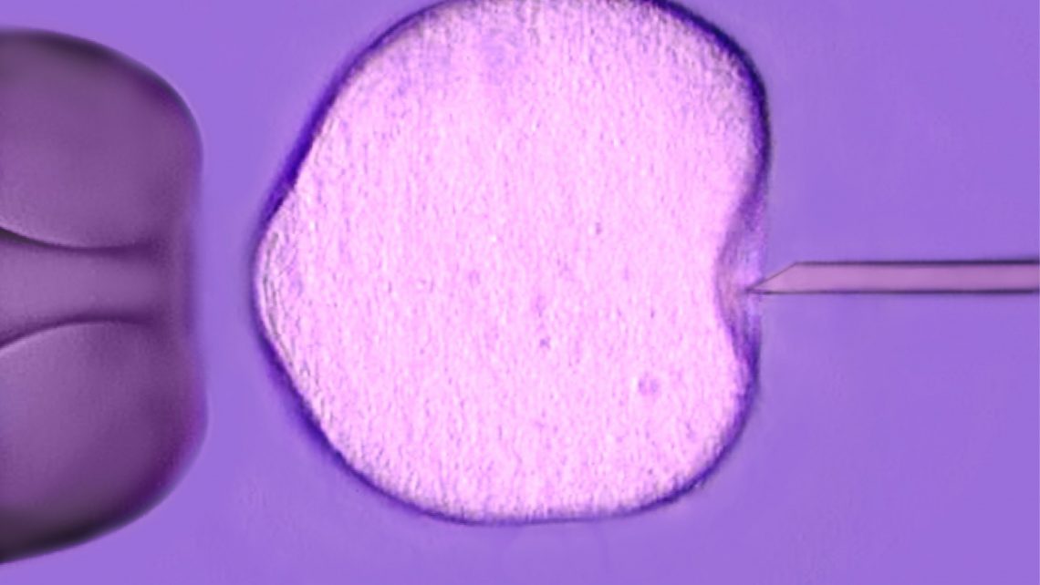 Instituto Bernabeu analyses if the number of ova obtained following stimulation has an impact on embryo quality