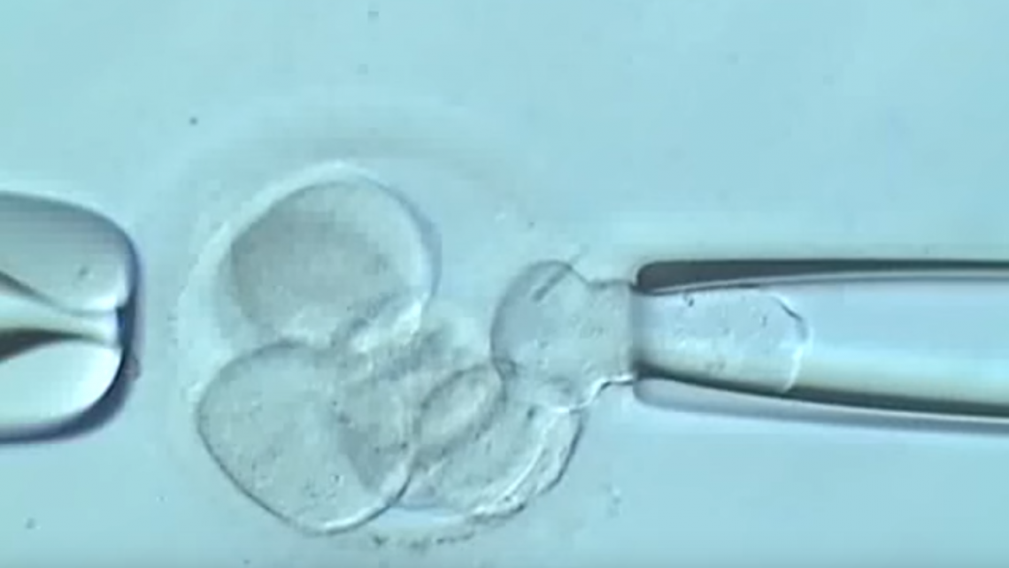 Klinische Studie über die am besten geeigneten Bereich für die Durchführung einer Biopsie bei den Embryonen. ESHRE 2016