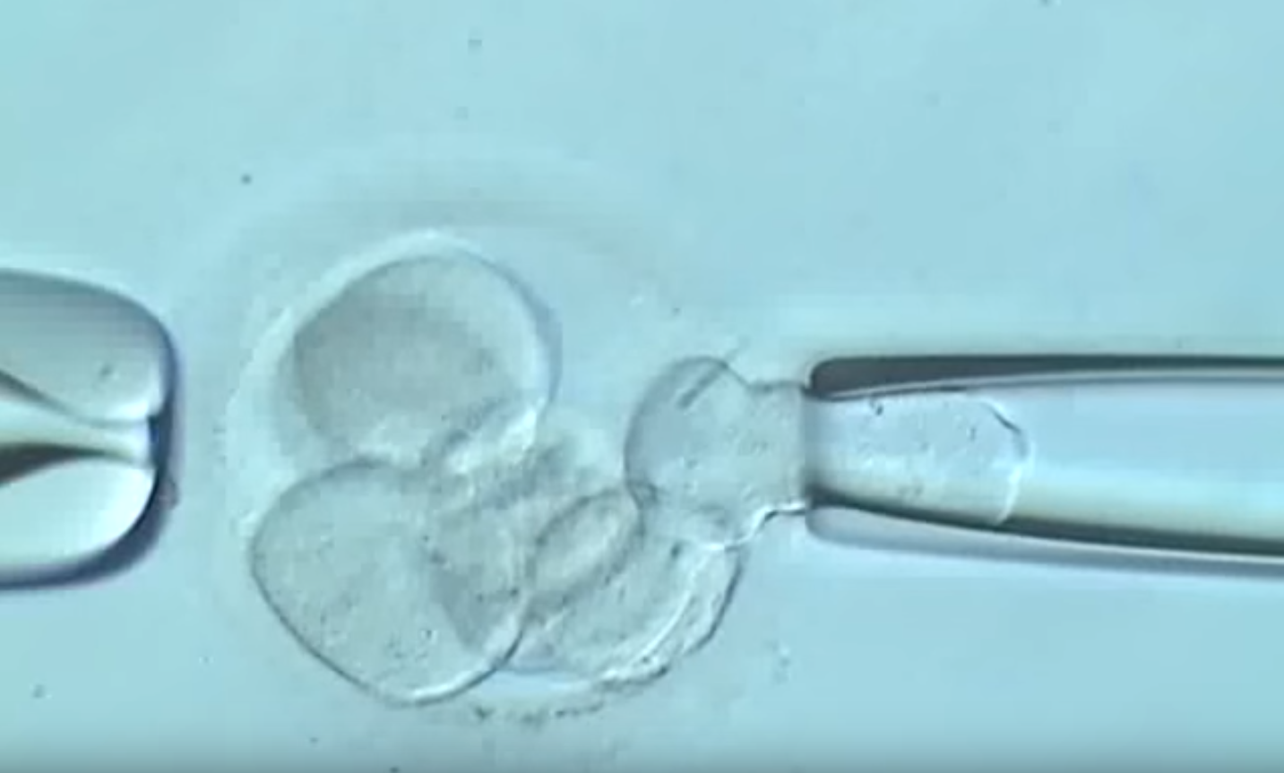 Klinische Studie über die am besten Bereich für die Durchführung einer Biopsie bei