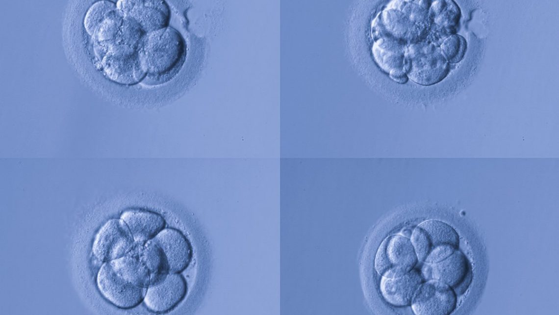 Eine neue Studie des Instituto Bernabeu bringt genetische Veränderungen mit Chromosomenanomalien beim Embryo und mit der Wahrscheinlichkeit einer evolutiven Schwangerschaft in Verbindung