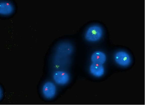 Die amerikanische Zeitschrift für Künstliche Befruchtung und Genetik berichtet über die Arbeit bezüglich der Spermaanalyse mit Hilfe der Fluoreszenz-in-situ-Hybridisierung und der Ergebnisse en las Techniken der künstlichen Befruchtung