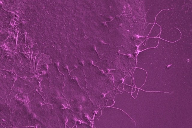 Das Instituto Bernabeu erforscht, ob der Tag der Extraktion der Spermien die Ergebnisse bezüglich einer Schwangerschaft beeinflusst