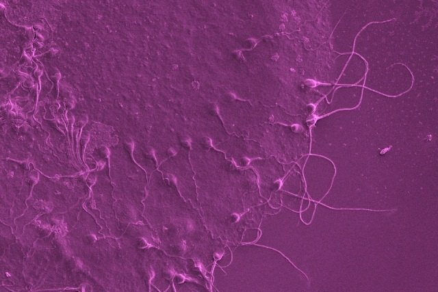 L’Instituto Bernabeu fait des recherches pour savoir si le jour de l’extraction des spermatozoïdes influence les résultats de grossesse