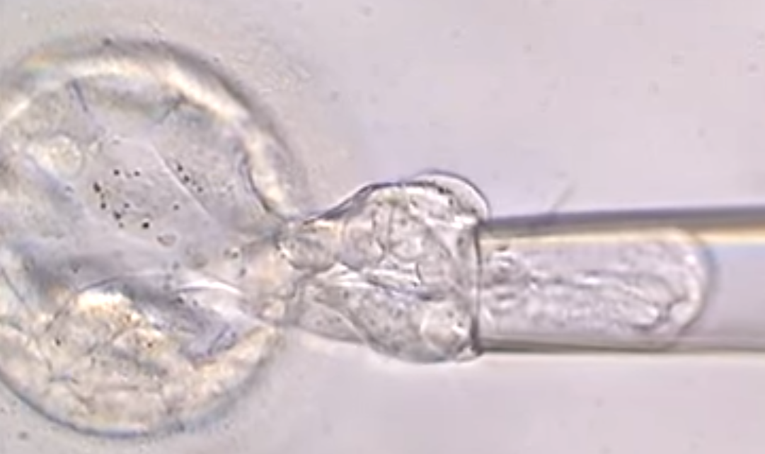 Instituto Bernabeu carries out research to determine if the number of twin pregnancies increases following embryo biopsy